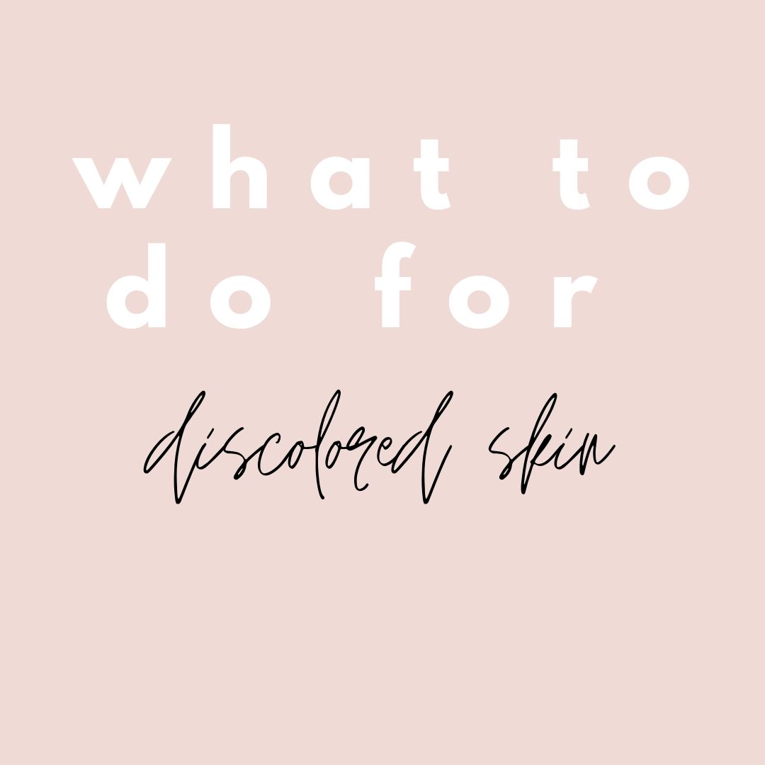 What to do for discolored skin